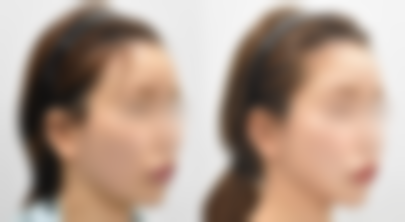 四、许昌正美韶华医疗整形的相关项目