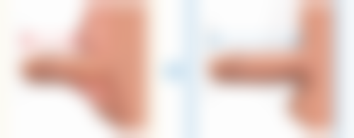 四、做安心隆胸手术安心吗？美学与自然度建议