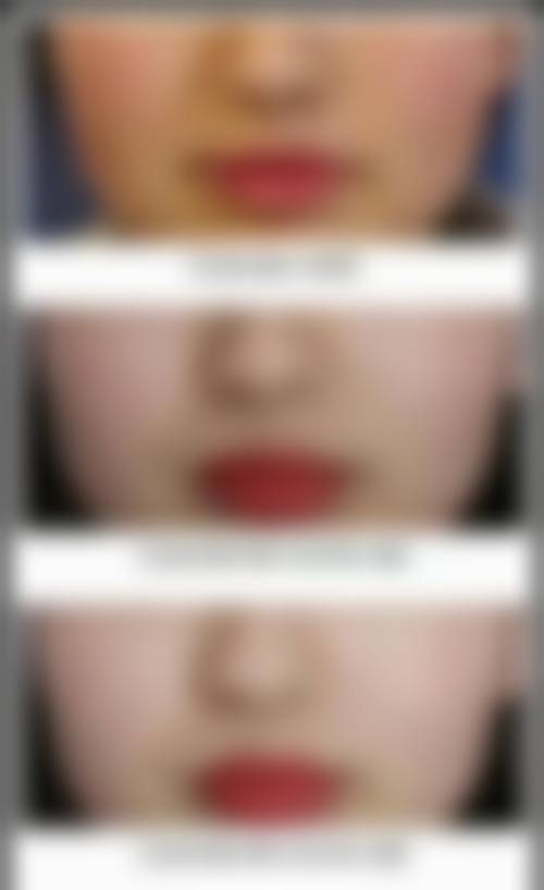 九、泸州泸美医疗美容诊所真实的患者评价