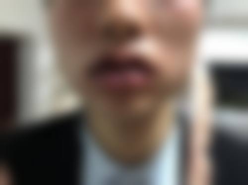 九、威海现代医院整形美容中 心真实的患者评价