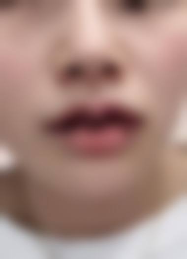 六、威海现代医院整形美容中 心价格表