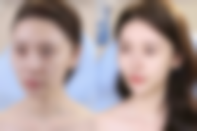 四、及时就医的重要性