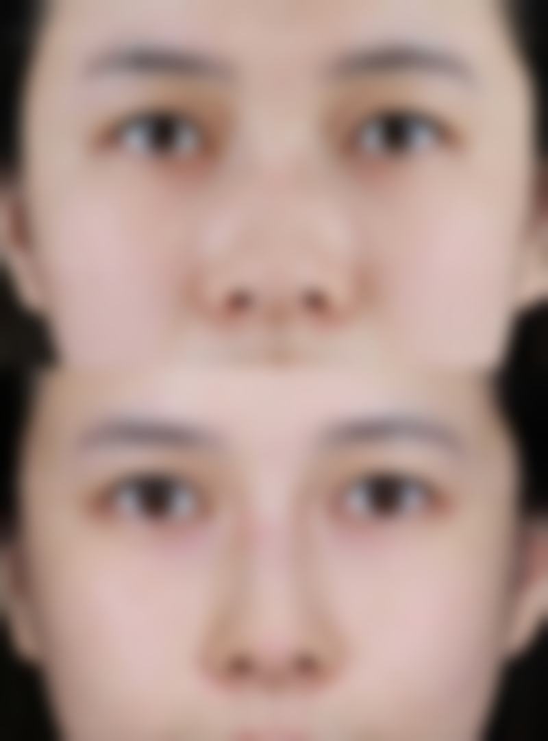 修复疤痕中药哪味最好？术后疤痕红肿发痒有炎症，这些中药除疤抗炎双管齐下！ 