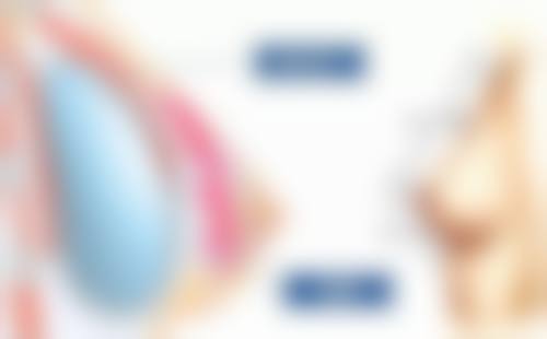 五、注射填充快速改善泪沟