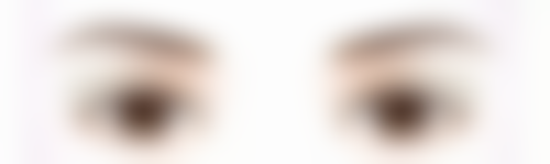 一、了解眼袋泪沟的成因