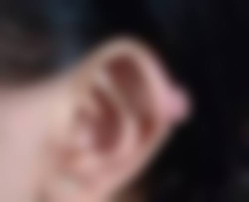 一、做完双眼皮眨眼的真相