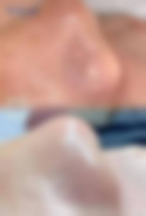 四、毕节颐美纪医疗美容门诊部特色项目