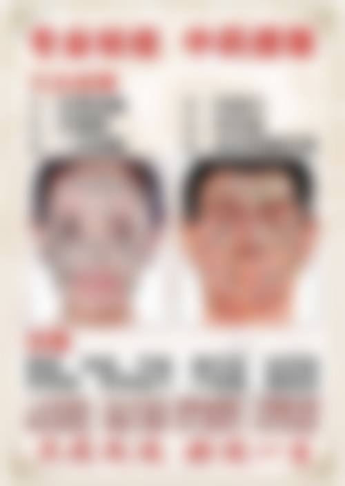 二、全仁基擅长项目