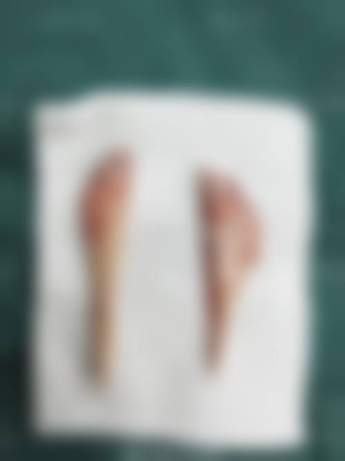 八、毕节颐美纪医疗美容门诊部真实的患者评价