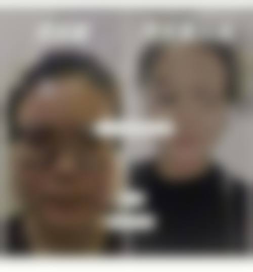 六、厦门思明广肤皮肤科门诊部价格表