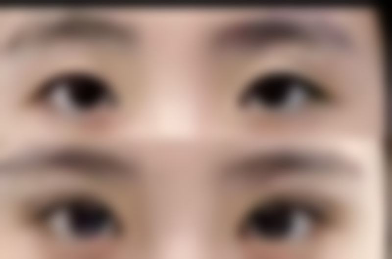 九、韩国fine整形外科真实的患者评价