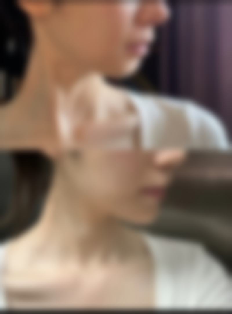 三、正常术后反应与异常情况对比