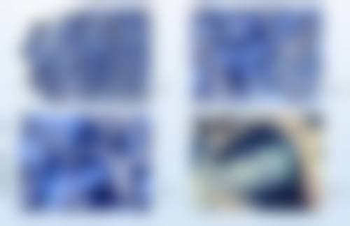 二、眼袋的常见类型及对应解决方案