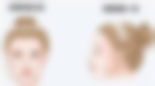 四、术后护理与美学改善建议