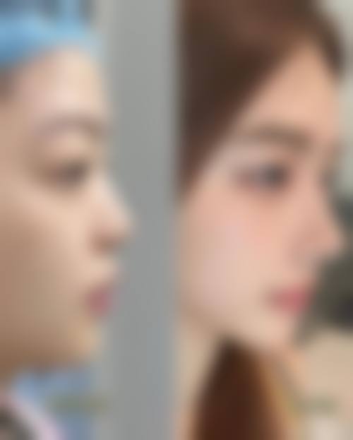 六、张镭真实的患者评价