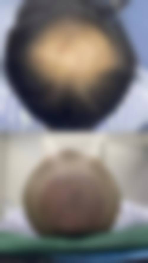 五、陈中怎么预约？