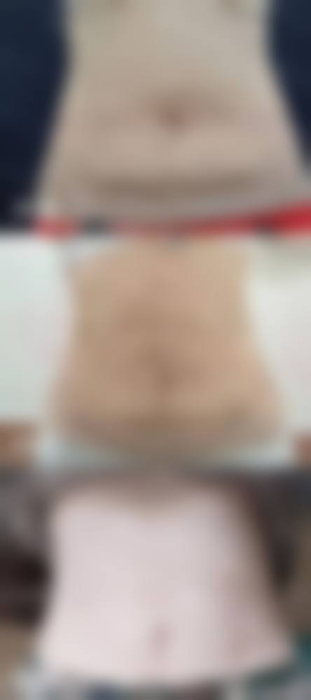 四、济南民生医院整形科特色项目