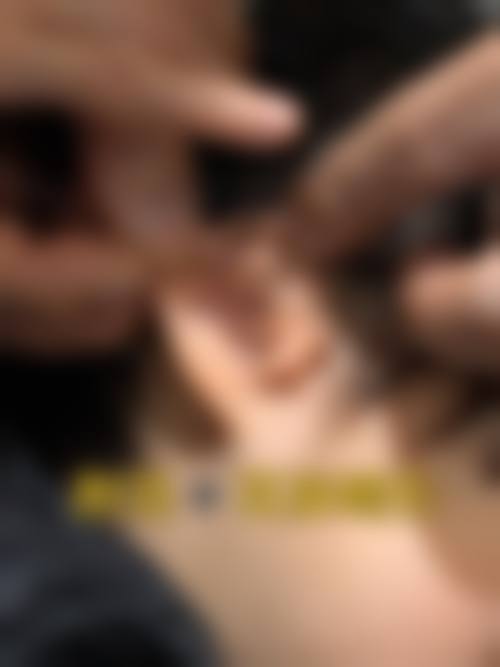 八、北京玛丽整形医院真实的患者评价