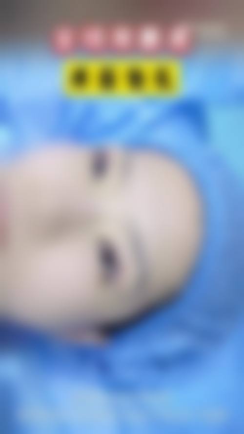 五、张镭怎么预约？