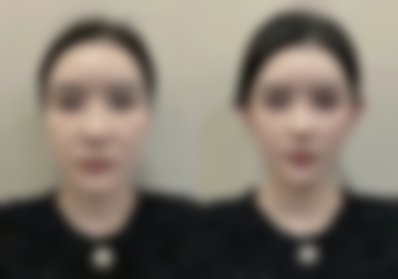 去眼袋属于什么科？整形外科、医疗美容科及其他可选科室全揭秘！ 