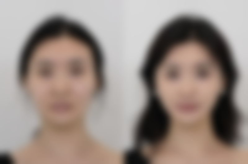 四、选择正规机构的重要性