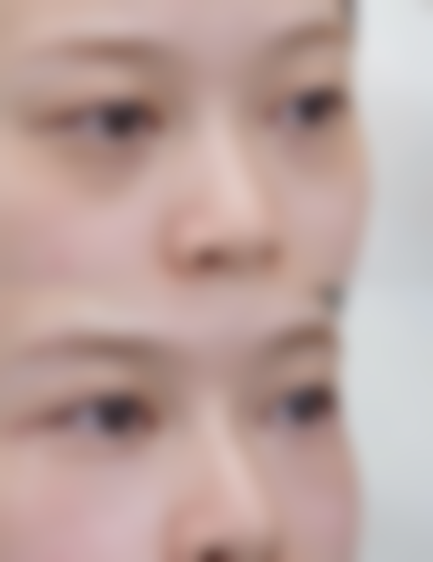 四、昆明大华医疗美容医院特色项目