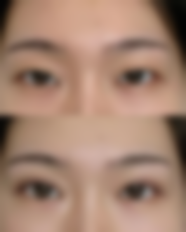 四、美学护理建议