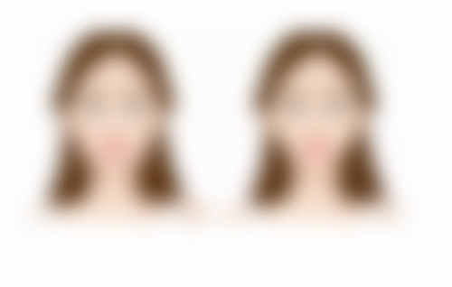 什么方法去疙瘩疤痕好得快？常见医美手段与辅助护理结合或为良策 