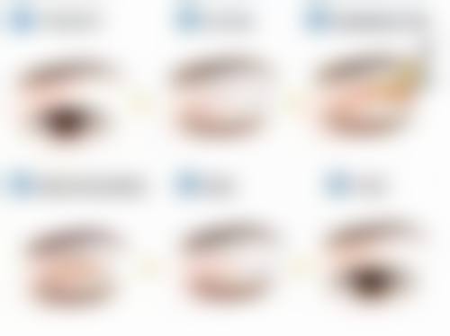 三、双眼皮术后的护理注意事项