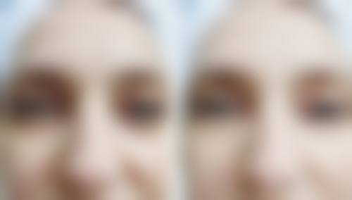 八、济南中俪美整形医疗美容门诊部真实的患者评价