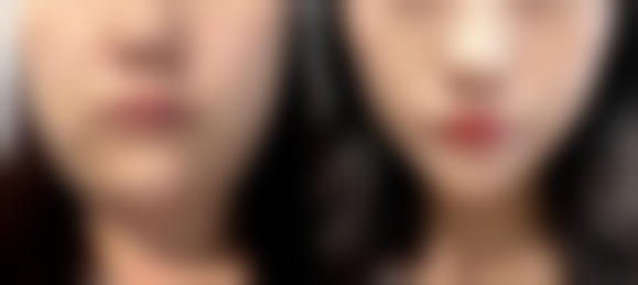 三、赵国水技术优势