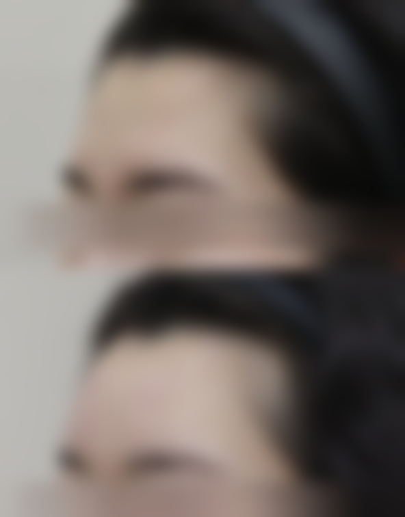 六、西安韩媚医疗美容医院价格表