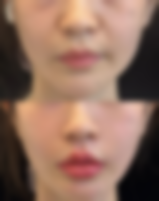 八、西安韩媚医疗美容医院预约方式