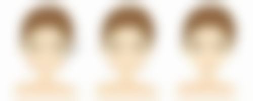 一、早期干预与预防油烫伤疤痕