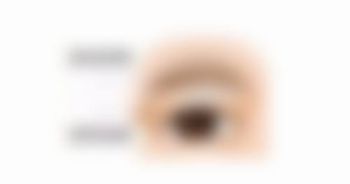 五、日常护理与就医建议应对油烫伤疤痕