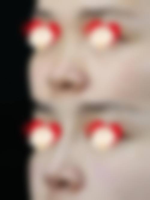 九、杭州颜星晶致美医疗美容门诊部真实的患者评价