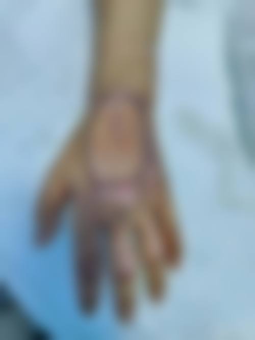 五、林子豪怎么预约？