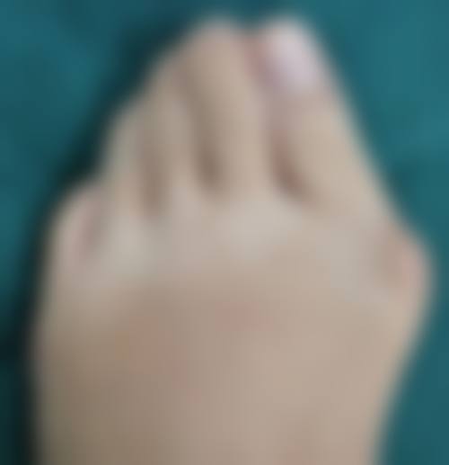 五、不同人群的注意事项