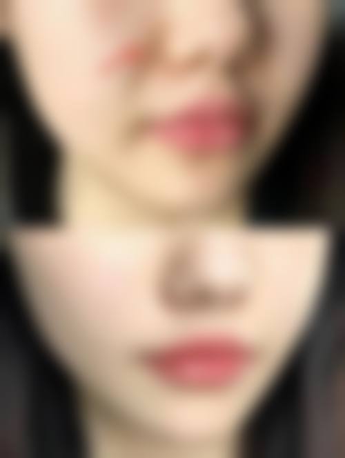 七、安康贝仪斯缇整形医院预约方式