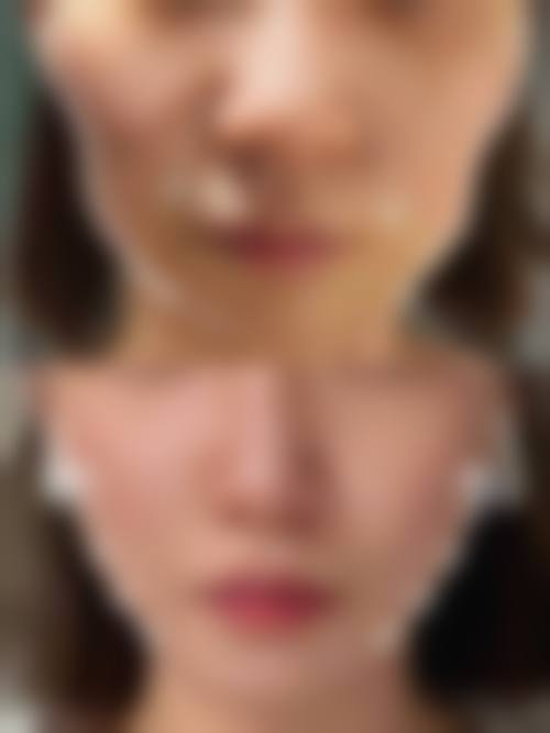 五、安康贝仪斯缇整形医院价格表