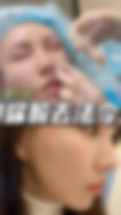 九、韩国来福琳整形医院真实的患者评价