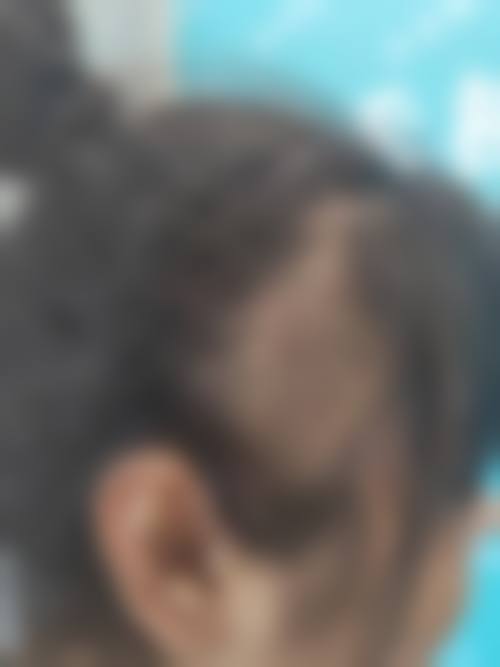 二、韩国江南黛雅皮肤科怎么样？