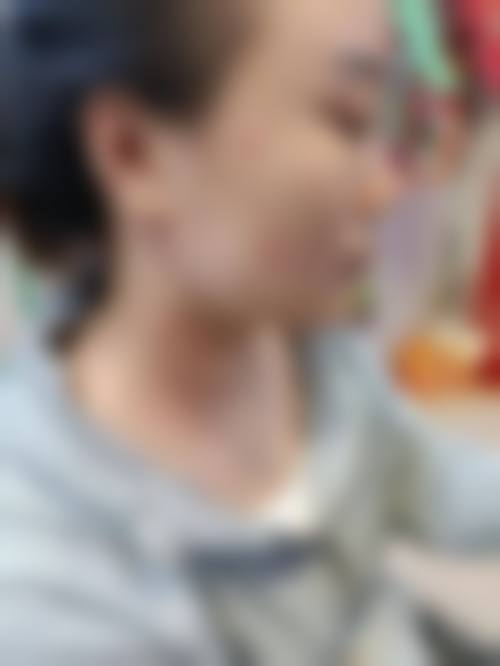 六、韩国来福琳整形医院价格表