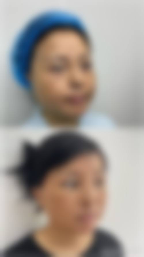 八、韩国江南黛雅皮肤科预约方式