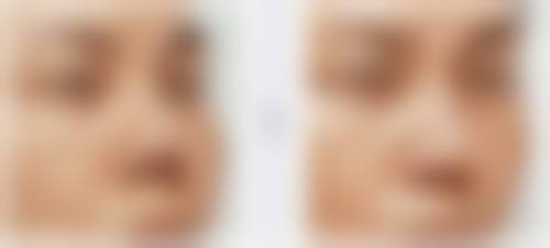 四、韩国江南黛雅皮肤科特色项目