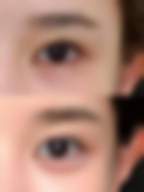 八、安康贝仪斯缇整形医院真实的患者评价