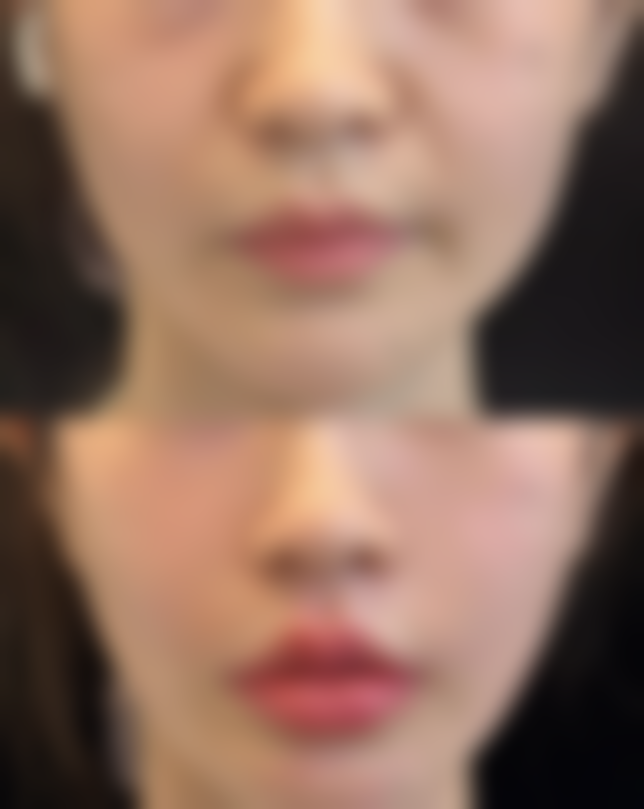 四、修复方案与修复周期