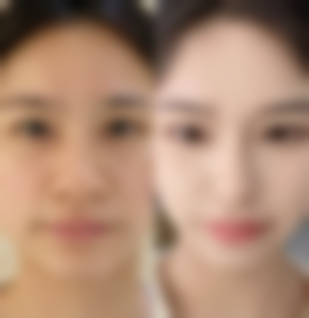 三、吕忠技术优势