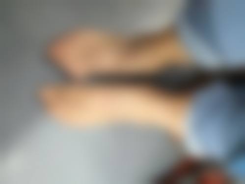 二、处理被虫子咬的疤痕变黑的关键步骤