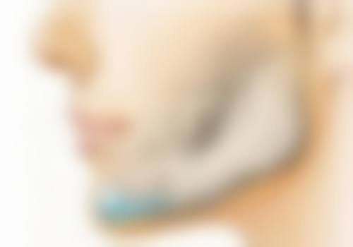 去除眼袋后有细纹可以恢复吗？了解原因与应对方法助你重焕眼部光彩